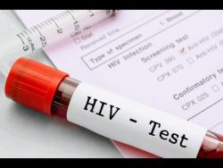 Gov’t to spend $1 billion on National HIV/AIDS Response Project | News